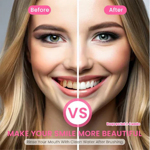 Niacinamide - For Teeth Whitening & Health!